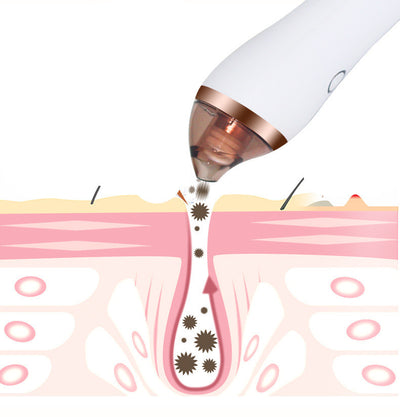 4 IN 1 Blackhead Remover & Pore Vacuum