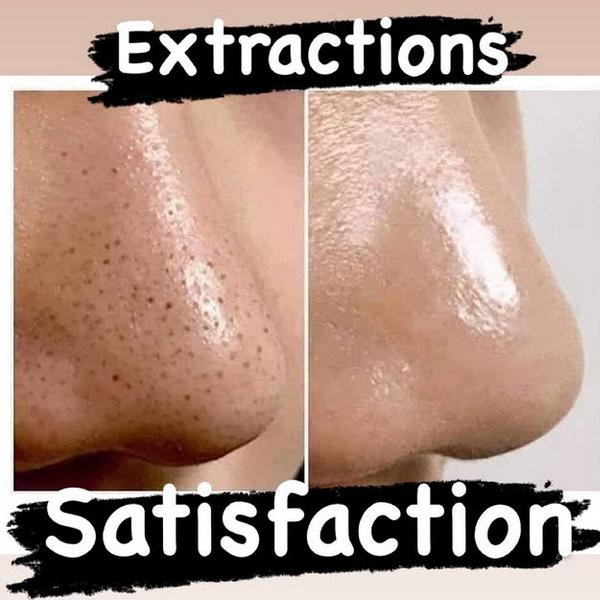 Rechargeable Pore Vacuum – Blackhead Remover Tool