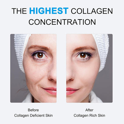 Anti-Aging Facial Mask-Collagen Anti-Wrinkle